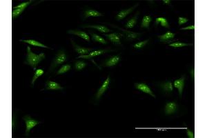 Immunofluorescence of purified MaxPab antibody to DUSP12 on HeLa cell. (DUSP12 antibody  (AA 1-340))