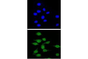 Confocal immunofluorescent analysis of AIRE Antibody (Center) (ABIN655031 and ABIN2844662) with 293 cell followed by Alexa Fluor® 488-conjugated goat anti-rabbit lgG (green). (AIRE antibody  (AA 64-92))
