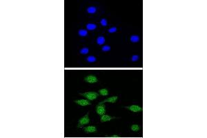 Confocal immunofluorescent analysis of AIRE Antibody (Center) (ABIN655031 and ABIN2844662) with 293 cell followed by Alexa Fluor® 488-conjugated goat anti-rabbit lgG (green).