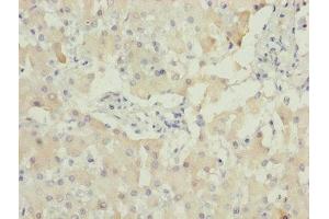 Immunohistochemistry of paraffin-embedded human liver tissue using ABIN7142330 at dilution of 1:100