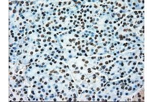 Image no. 5 for anti-TYRO3 Protein Tyrosine Kinase (TYRO3) antibody (ABIN1501605)