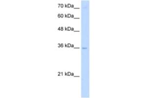Western Blotting (WB) image for anti-Primase, DNA, Polypeptide 2 (58kDa) (PRIM2) antibody (ABIN2463269)