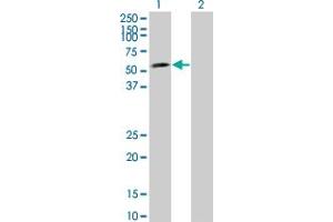 Western Blot analysis of LEF1 expression in transfected 293T cell line by LEF1 monoclonal antibody (M08), clone 2E2. (LEF1 antibody  (AA 33-138))