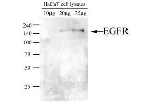 Image no. 1 for anti-Epidermal Growth Factor Receptor (EGFR) (AA 424-605) antibody (ABIN782452) (EGFR antibody  (AA 424-605))