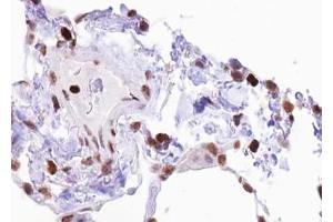 ABIN6267423 at 1/100 staining human lung tissue sections by IHC-P.