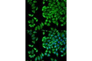 Immunofluorescence analysis of HeLa cells using WNK1 antibody (ABIN5971394).