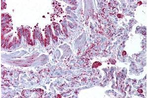 Anti-GABRB3 antibody IHC staining of human lung. (GABRB3 antibody  (AA 180-229))