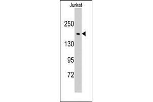 Western blot analysis of anti-EPRS Pab in Jurkat cell line lysates (35ug/lane). (EPRS antibody  (N-Term))