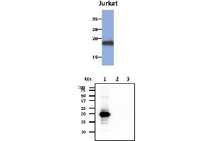 The cell lysates of Jurkat (30ug) were resolved by SDS-PAGE, transferred to PVDF membrane and probed with anti-human MAFK antibody (1:1000). (MAFK antibody)