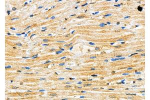 ABIN6257178 and ABIN6273623 at 1/100 staining Rat heart tissue by IHC-P. (FGF12 antibody  (C-Term))