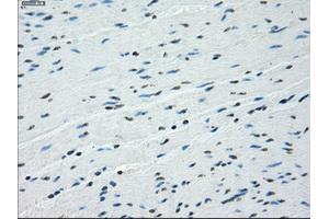 Image no. 3 for anti-Budding Uninhibited By Benzimidazoles 1 Homolog beta (Yeast) (BUB1B) antibody (ABIN1496996) (BUB1B antibody)