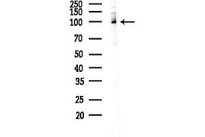anti-General Transcription Factor IIIC, Polypeptide 2, beta 110kDa (GTF3C2) (N-Term) antibody