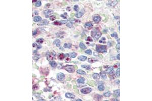 Formalin-fixed and paraffin-embedded human Spleen tissue reacted with SNAI1 antibody (N-term D24) (ABIN388809 and ABIN2850429) , which was peroxidase-conjugated to the secondary antibody, followed by AEC staining. (SNAIL antibody  (N-Term))