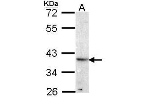 Western Blotting (WB) image for anti-ATPase, H+ Transporting, Lysosomal Accessory Protein 2 (ATP6AP2) (AA 146-320) antibody (ABIN467627) (ATP6AP2 antibody  (AA 146-320))