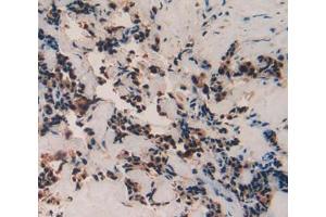 Used in DAB staining on fromalin fixed paraffin- embedded breast cancer tissue (TAF12 antibody  (AA 1-161))