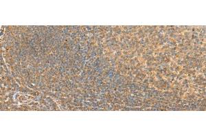 Immunohistochemistry of paraffin-embedded Human tonsil tissue using RAC3 Polyclonal Antibody at dilution of 1:45(x200) (RAC3 antibody)