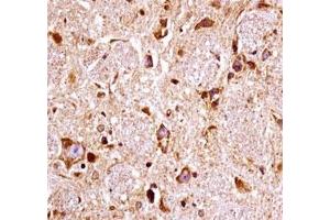 FGFR3 antibody immunohistochemistry analysis in formalin fixed and paraffin embedded mouse brain tissue. (FGFR3 antibody  (AA 468-495))