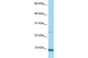 WB Suggested Anti-SPRR1A Antibody Titration: 1. (SPRR1A antibody  (Middle Region))