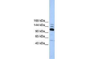 WB Suggested Anti-POLR3B Antibody Titration:  0. (POLR3B antibody  (C-Term))