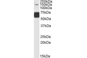 ABIN334410 (1µg/ml) staining of Human Brain (Cerebellum) lysate (35µg protein in RIPA buffer). (GRIK1 antibody  (Internal Region))