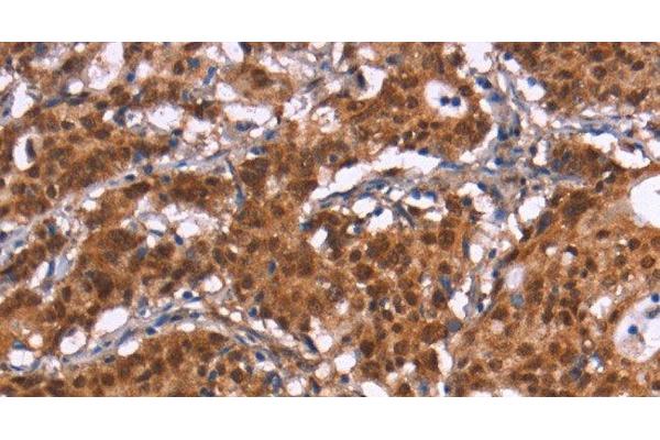 HIPK1 antibody