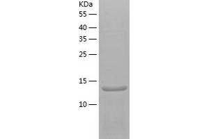 Western Blotting (WB) image for SH2 Domain Containing 1A (SH2D1A) (AA 1-128) protein (His tag) (ABIN7284555) (SH2D1A Protein (AA 1-128) (His tag))