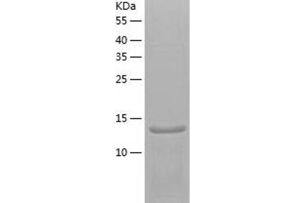 SH2D1A Protein (AA 1-128) (His tag)