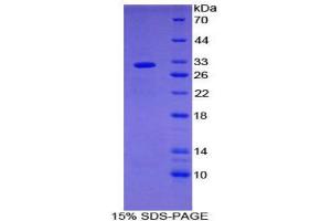 SDS-PAGE (SDS) image for Src Homology 2 Domain Containing Adapter Protein B (AA 248-484) protein (His tag) (ABIN2126848)