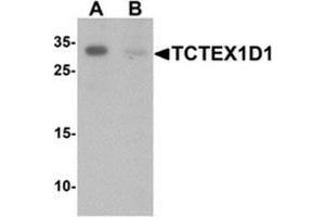 Western blot analysis of TCTEX1D1 in K562 cell lysate with TCTEX1D1 Antibody  at 1 ug/mL in (A) the absence and (B) the presence of blocking peptide.