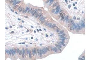 Immunohistochemistry (IHC) image for anti-Synaptosomal-Associated Protein, 23kDa (SNAP23) (AA 1-210) antibody (ABIN7444226)