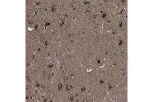 Immunohistochemical staining (Formalin-fixed paraffin-embedded sections) of human hippocampus with NEK7 polyclonal antibody  shows strong cytoplasmic positivity in neuronal cells at 1:20-1:50 dilution. (NEK7 antibody)