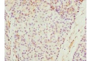 Immunohistochemistry of paraffin-embedded human pancreatic tissue using ABIN7168591 at dilution of 1:100 (SAP30BP antibody  (AA 1-308))