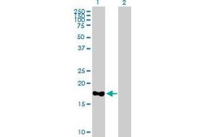 Western Blot analysis of MARCH2 expression in transfected 293T cell line by MARCH2 MaxPab polyclonal antibody. (MARCH2 antibody  (AA 1-176))