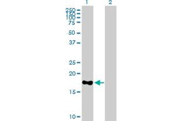MARCH2 antibody  (AA 1-176)