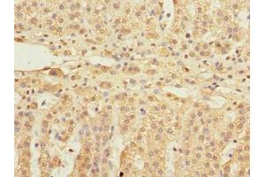 Immunohistochemistry of paraffin-embedded human adrenal gland tissue using ABIN7152154 at dilution of 1:100 (EIF3F antibody  (AA 88-357))