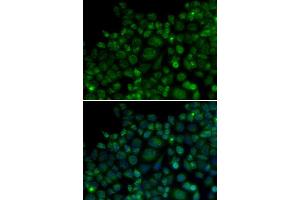 Immunofluorescence analysis of MCF7 cell using TLR7 antibody. (TLR7 antibody  (AA 30-230))