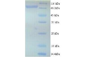 SDS-PAGE (SDS) image for Ribonucleotide Reductase M1 (RRM1) (AA 1-792), (full length) protein (His tag) (ABIN4975907) (RRM1 Protein (AA 1-792, full length) (His tag))