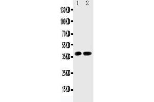Anti-Cdk6 antibody, Western blotting Lane 1: Rat Testis Tissue Lysate Lane 2: Rat Lung Tissue Lysate (CDK6 antibody  (C-Term))