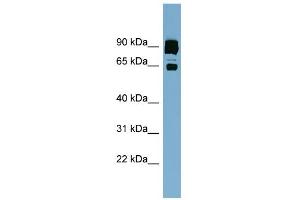 WB Suggested Anti-CLPTM1L Antibody Titration:  0. (CLPTM1L antibody  (Middle Region))