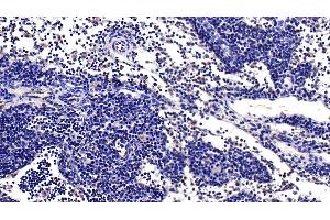 Immunohistochemistry (IHC) image for anti-Interferon alpha (IFNA) (AA 28-227) antibody (ABIN7437731)