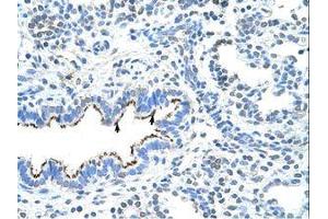 Image no. 1 for anti-Zinc Finger Protein 239 (ZNF239) (AA 160-209) antibody (ABIN6736298) (ZNF239 antibody  (AA 160-209))