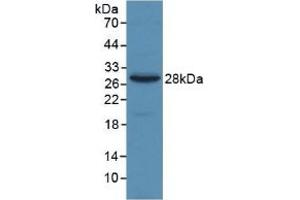 Detection of Recombinant a2M, Human using Monoclonal Antibody to Alpha-2-Macroglobulin (a2M) (alpha 2 Macroglobulin antibody  (AA 616-856))