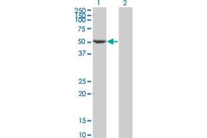 Western Blot analysis of FLI1 expression in transfected 293T cell line by FLI1 monoclonal antibody (M05), clone 1F6. (FLI1 antibody  (AA 1-452))