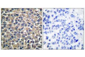 Immunohistochemistry (IHC) image for anti-Matrix Metallopeptidase 19 (MMP19) (N-Term) antibody (ABIN1848680) (MMP19 antibody  (N-Term))