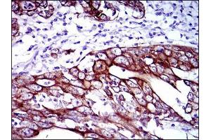 Immunohistochemistry (IHC) image for anti-Keratin 5 (KRT5) antibody (ABIN969508)