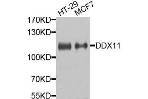 Western blot analysis of extracts of HT29 and MCF7 cells, using DDX11 antibody. (DDX11 antibody)