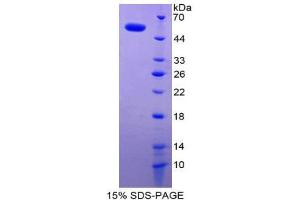 SDS-PAGE (SDS) image for Syndecan 1 (SDC1) (AA 23-253) protein (His tag,GST tag) (ABIN1878608) (Syndecan 1 Protein (SDC1) (AA 23-253) (His tag,GST tag))