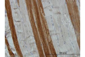 Immunoperoxidase of monoclonal antibody to TOM1 on formalin-fixed paraffin-embedded human skeletal muscle. (TOM1 antibody  (AA 394-491))