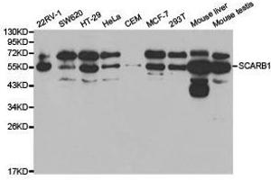 Western Blotting (WB) image for anti-Scavenger Receptor Class B, Member 1 (SCARB1) antibody (ABIN1874696)