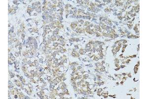 Immunohistochemistry (Paraffin-embedded Sections) (IHC (p)) image for anti-Transcription Elongation Factor, Mitochondrial (TEFM) (AA 36-210) antibody (ABIN6148990)